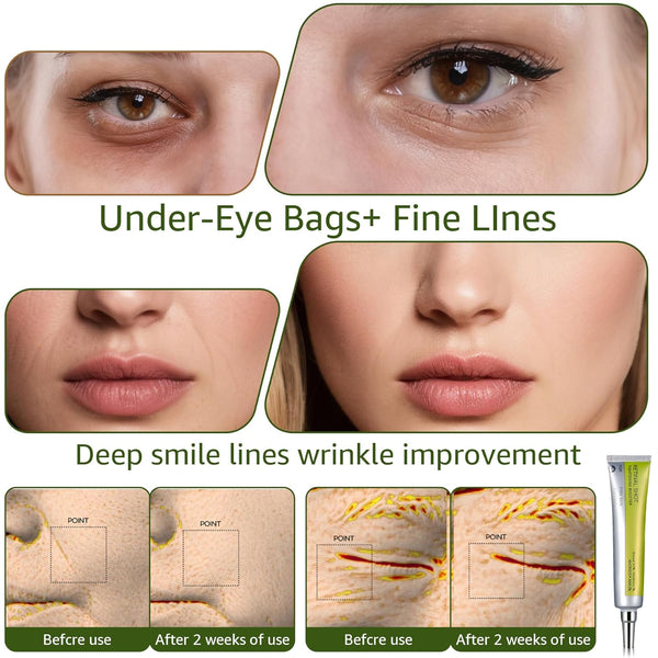 Fermitate Instantanee pentru Ten