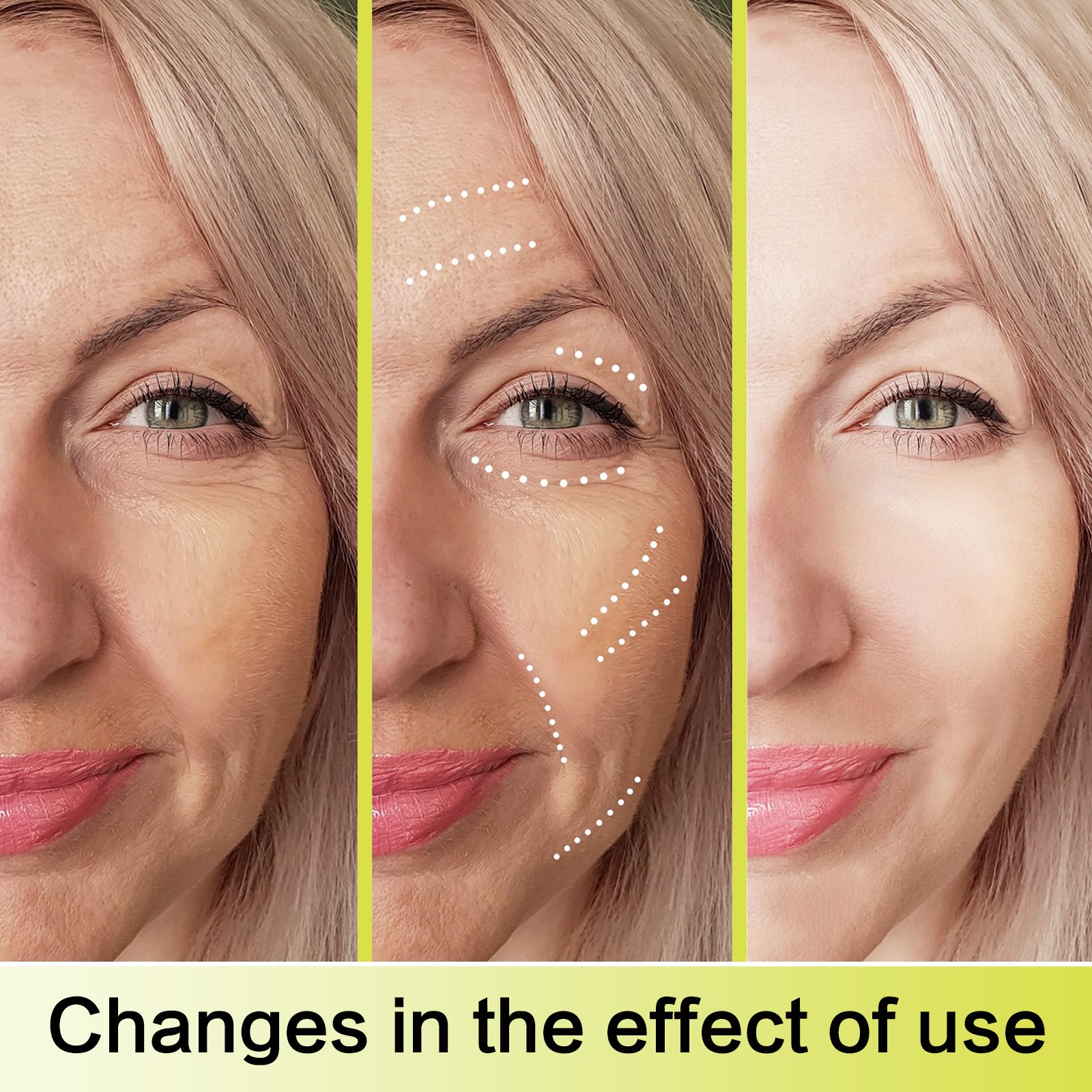 Fermitate Instantanee pentru Ten